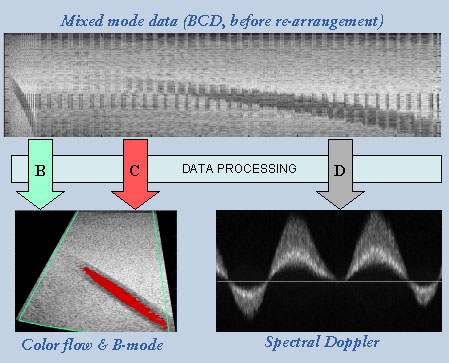Mixed mode data (BCD, before arrangement)
